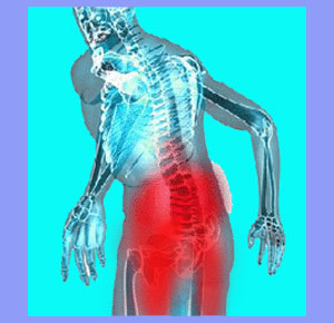 Alleviate Sciatica