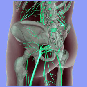Nerve Ablation for Sciatica