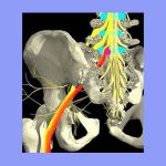 icd 10 code for sciatic nerve impingement
