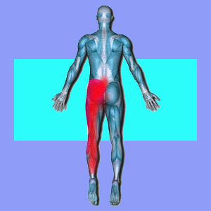 Sciatica Relief